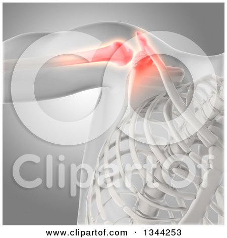 Clipart of a 3d Xray of a Man's Painful Shoulder and Visible Skeleton on Gray - Royalty Free Illustration by KJ Pargeter