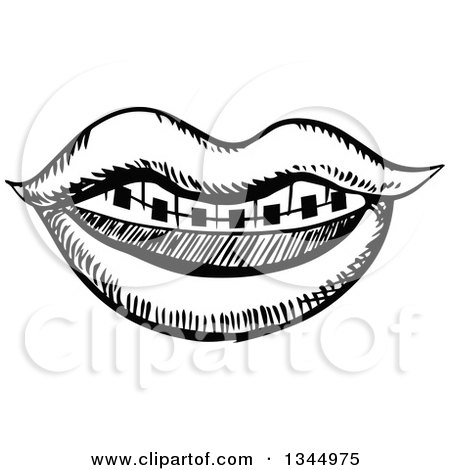 Clipart of a Black and White Sketched Mouth with Braces - Royalty Free Vector Illustration by Vector Tradition SM