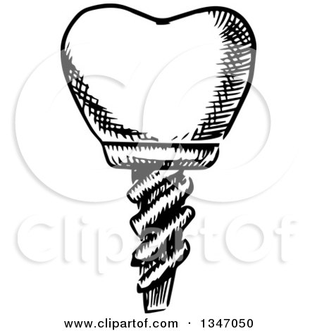 Clipart of a Black and White Sketched Dental Implant - Royalty Free Vector Illustration by Vector Tradition SM