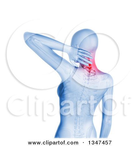 Clipart of a 3d Blue Anatomical Woman with Glowing Neck Pain and Visible Skeleton, over White - Royalty Free Illustration by KJ Pargeter