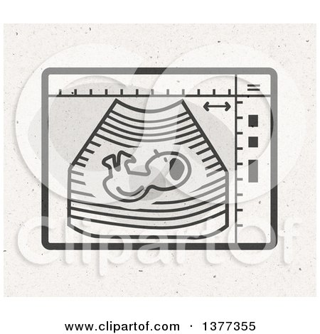 Clipart of a Baby on an Ultrasound Screen on Fiber Texture - Royalty Free Illustration by NL shop