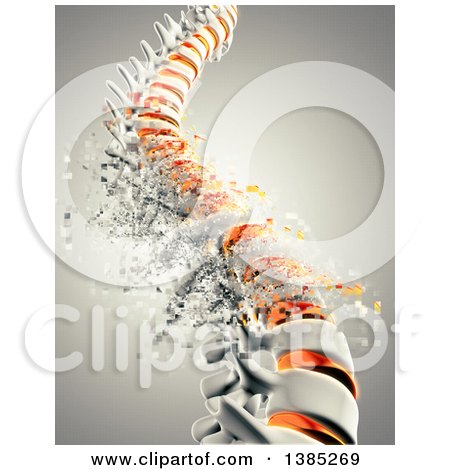 Clipart of a 3d Bursting Spine - Royalty Free Illustration by KJ Pargeter