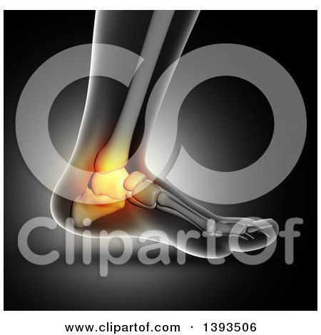 Clipart of a 3d Closeup of a Human Foot with Glowing Ankle Bone Pain, on Gray - Royalty Free Illustration by KJ Pargeter