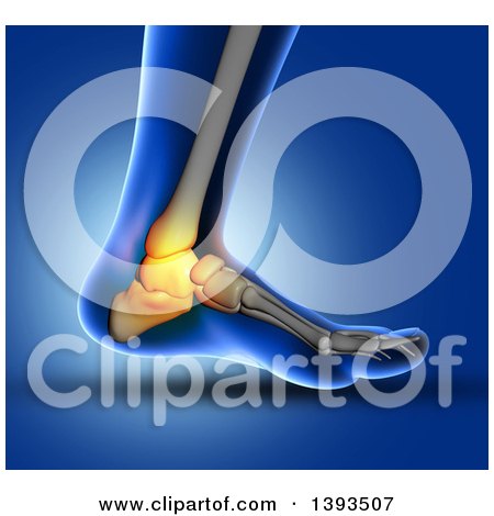 Clipart of a 3d Closeup of a Human Foot with Glowing Ankle Bone Pain, on Blue - Royalty Free Illustration by KJ Pargeter