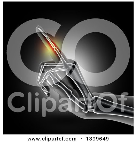 Clipart of a 3d Xray of a Woman's Hand with Visible Bones and Glowing Pain, on Black - Royalty Free Illustration by KJ Pargeter