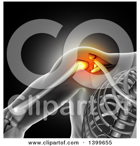 Clipart of a 3d Xray of a Man's Painful Shoulder Joint and Visible Skeleton on Dark Gray - Royalty Free Illustration by KJ Pargeter