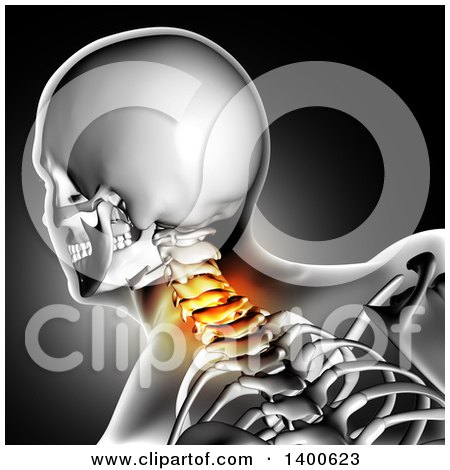 Clipart of a 3d Xray Anatomical Man with Visible Spine and Glowing Pain, over Gray - Royalty Free Illustration by KJ Pargeter