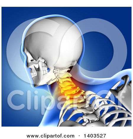 Clipart of a 3d Xray Anatomical Man with Visible Spine and Glowing Pain, over Blue - Royalty Free Illustration by KJ Pargeter