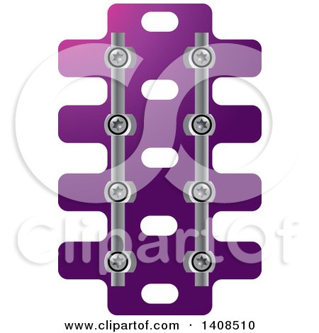 Clipart of a Medical Spine with Screws - Royalty Free Vector Illustration by Lal Perera