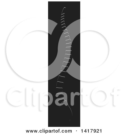 Clipart of a Human Spine on a Dark Gray Background - Royalty Free Vector Illustration by Lal Perera