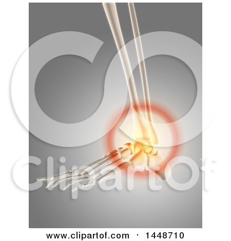 Clipart of a 3d Human Skeleton of a Foot with Glowing Ankle Pain, on a Gray Background - Royalty Free Illustration by KJ Pargeter