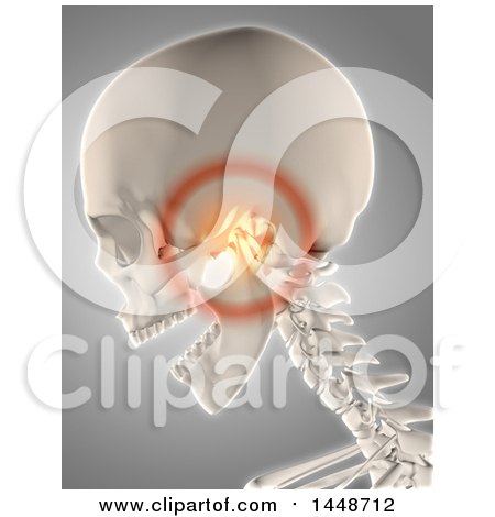 Clipart of a 3d Human Skeleton with Glowing Jaw Pain, on a Gray Background - Royalty Free Illustration by KJ Pargeter