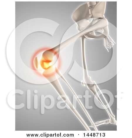 Clipart of a 3d Human Skeleton of a Knee with Glowing Pain, on a Gray Background - Royalty Free Illustration by KJ Pargeter