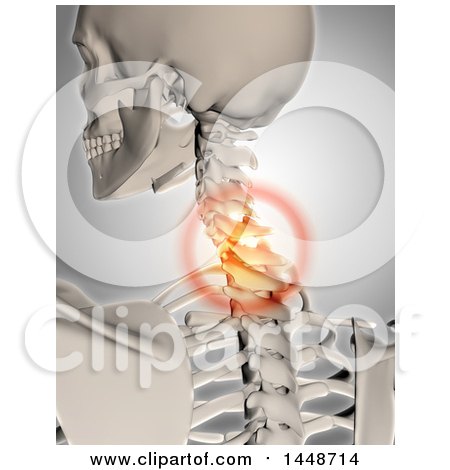 Clipart of a 3d Human Skeleton of a Spine with Glowing Neck Pain, on a Gray Background - Royalty Free Illustration by KJ Pargeter