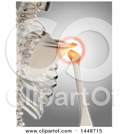 Clipart of a 3d Human Skeleton with Glowing Shoulder Pain, on a Gray Background - Royalty Free Illustration by KJ Pargeter