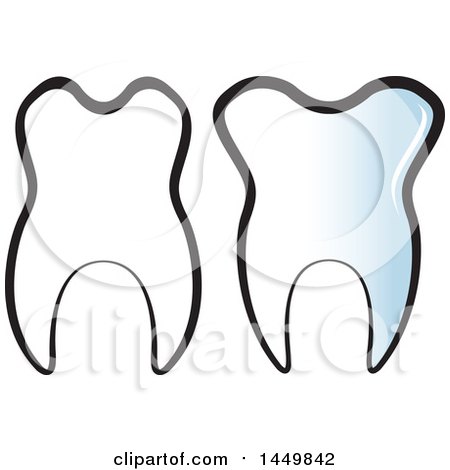 Clipart Graphic of a Gradient and Black and White Tooth - Royalty Free Vector Illustration by Lal Perera