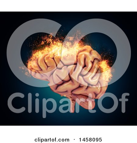 Clipart of a 3d Burning Human Brain - Royalty Free Illustration by KJ Pargeter