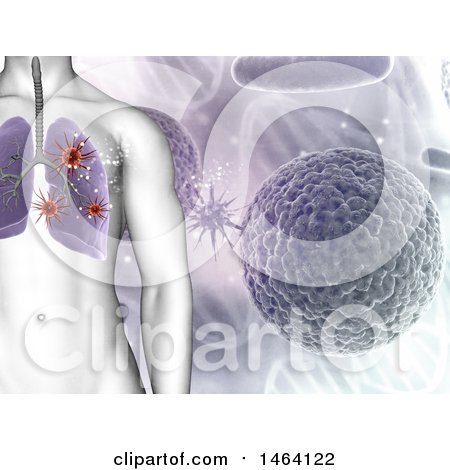 Clipart of a 3d Background of Double Helix Dna Strands and a Person with Viruses or Cancer in the Lungs - Royalty Free Illustration by KJ Pargeter