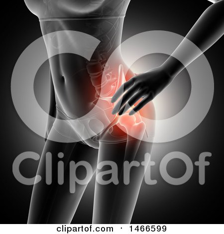 Clipart of a 3d Anatomical Woman with Red Highlighted Hip, on a Dark Background - Royalty Free Illustration by KJ Pargeter