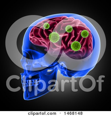 Clipart of a 3d Profiled Human Skull with Virus Cells Attacking the Brain, on Black - Royalty Free Illustration by KJ Pargeter