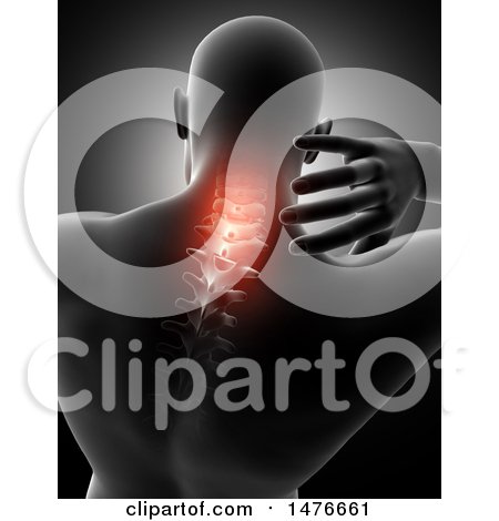 Clipart of a 3d Rear View of a Medical Anatomical Male Reaching Back, with Glowing Neck, on Black - Royalty Free Illustration by KJ Pargeter