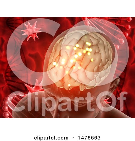 Clipart of a 3d Brain Being Attacked by a Virus, over Red Dna Strands - Royalty Free Illustration by KJ Pargeter