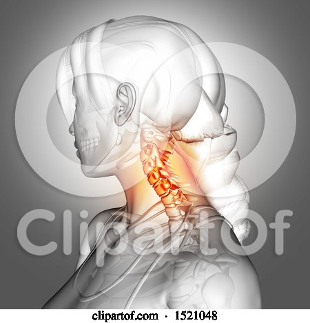 Clipart of a 3d Anatomical Woman with Highlighted Neck Pain - Royalty Free Illustration by KJ Pargeter