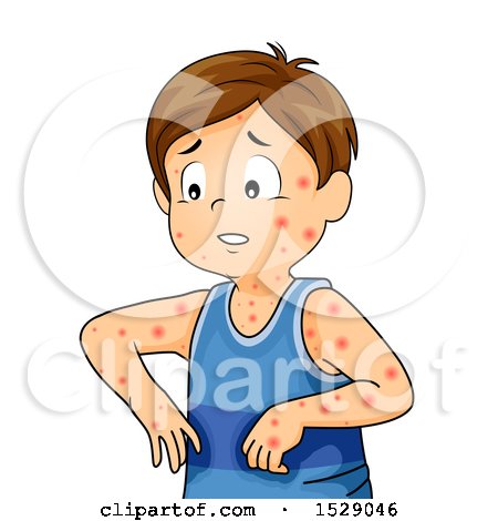 Clipart of a Boy Sick with Chicken Pox - Royalty Free Vector Illustration by BNP Design Studio