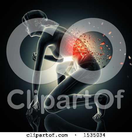 Clipart of a 3d Xray Woman with a Visible Spine and Shatters - Royalty Free Illustration by KJ Pargeter