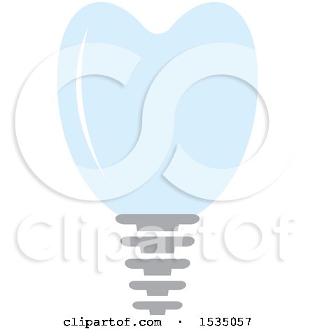 Clipart of a Tooth Implant - Royalty Free Vector Illustration by Lal Perera