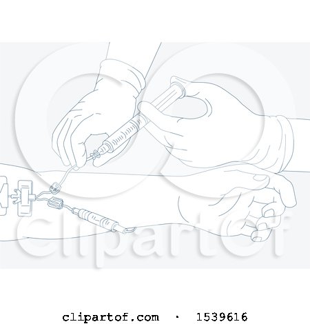 Clipart of a Diagram Illustrating Infusion Therapy by Administration of Medication Thru Intramuscular Injection - Royalty Free Vector Illustration by patrimonio