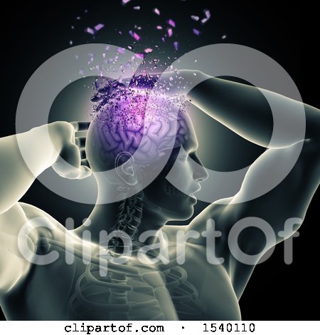 Clipart of a 3d Xray Man with Visible Purple Brain and Shatters - Royalty Free Illustration by KJ Pargeter