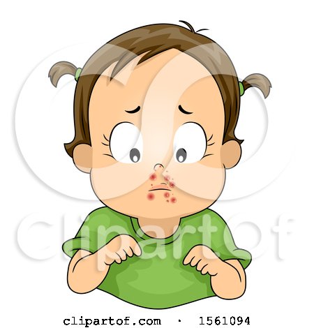 Clipart of a Brunette Toddler Girl with a Skin Infection on Her Face - Royalty Free Vector Illustration by BNP Design Studio