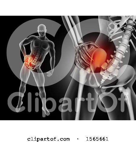 Clipart of a 3d Xray Man Holding His Painful Hip, on Black - Royalty Free Illustration by KJ Pargeter