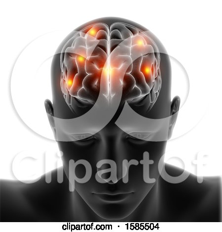 Clipart of a 3d Xray Male Head with Visible Brainand Highlighted Spots, on a White Background - Royalty Free Illustration by KJ Pargeter
