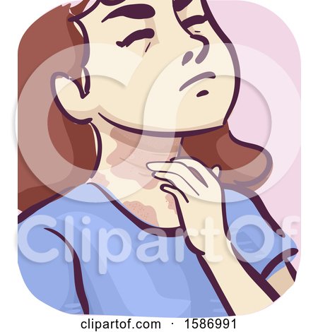 Clipart of a Girl with Rough, Darker and Itchy Skin on Her Neck - Royalty Free Vector Illustration by BNP Design Studio