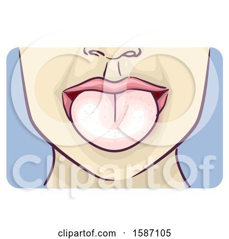 Clipart of a Person Showing a Pale Tongue - Royalty Free Vector Illustration by BNP Design Studio