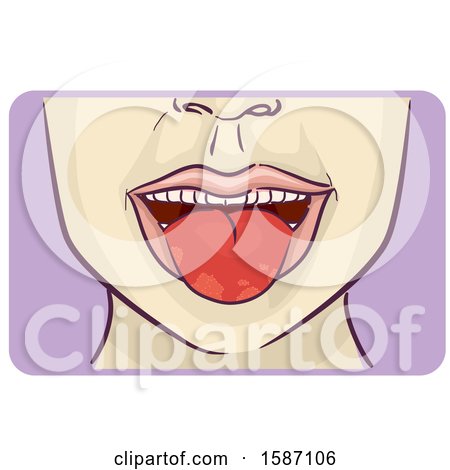 Clipart of a Person with Patches on Tongue - Royalty Free Vector Illustration by BNP Design Studio