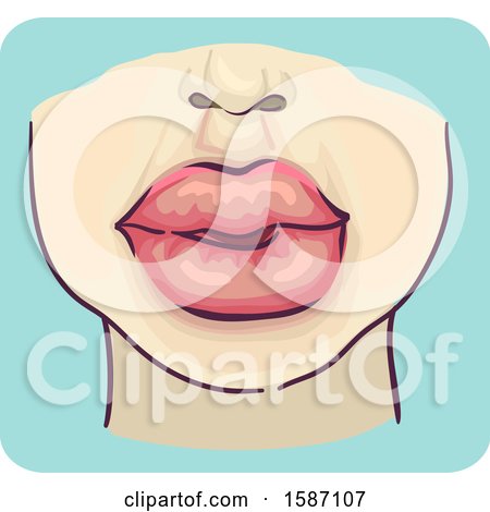 Clipart of a Person with Swollen Lips - Royalty Free Vector Illustration by BNP Design Studio