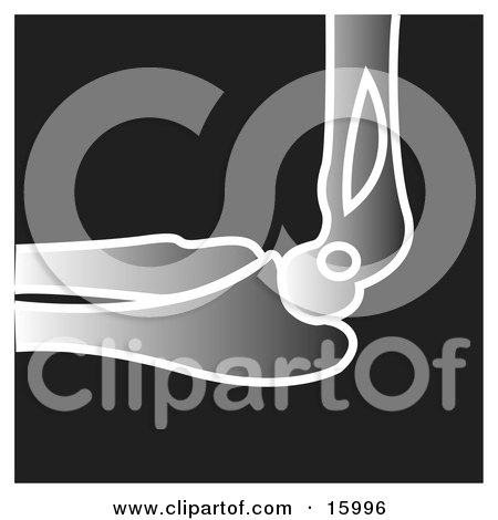 Xray Of An Elbow and Forearm Bone Clipart Illustration by Andy Nortnik