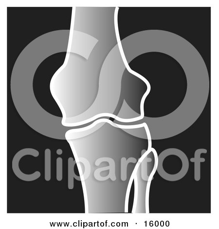 Xray of a Knee Joint Clipart Illustration by Andy Nortnik