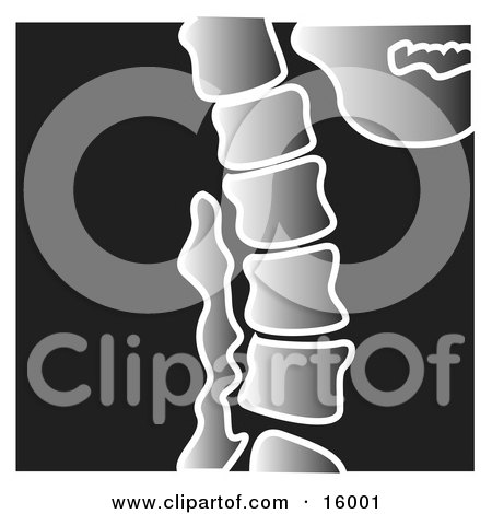 Xray of a Spine Clipart Illustration by Andy Nortnik