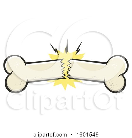 Clipart of a Breaking Bone - Royalty Free Vector Illustration by Hit Toon