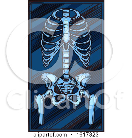 Skeleton Xray by Vector Tradition SM