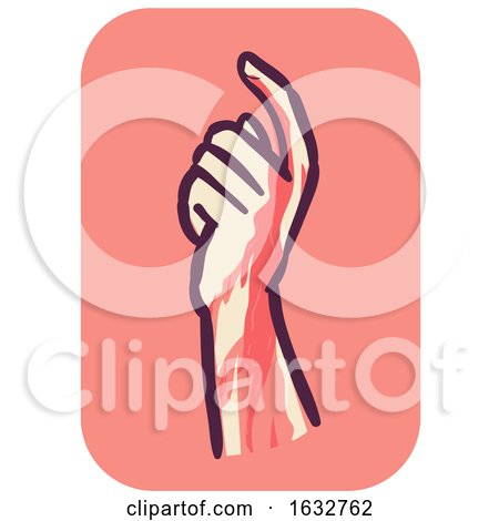 Hand Symptom Easy Bleed Illustration by BNP Design Studio