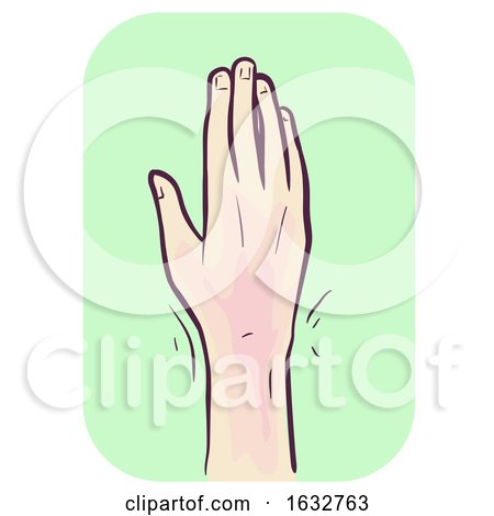 Hand Symptom Wrist Pain Illustration by BNP Design Studio