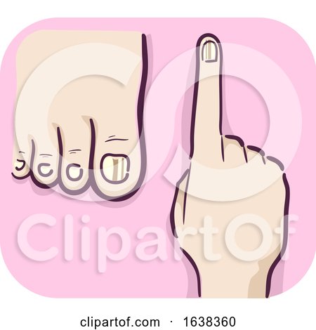 Hand Symptom Fingernail Toe Nail Dark Line by BNP Design Studio