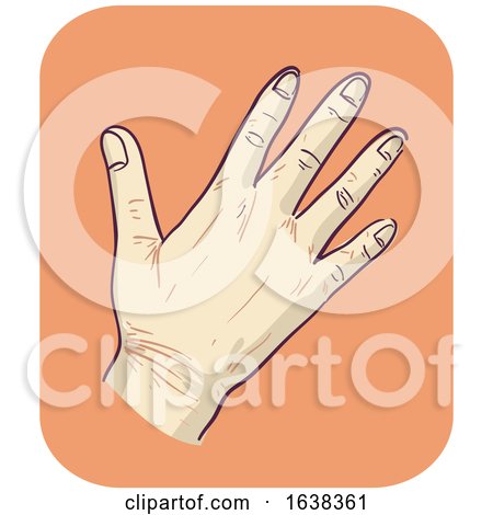 Hand Symptom Fragile Skin Illustration by BNP Design Studio