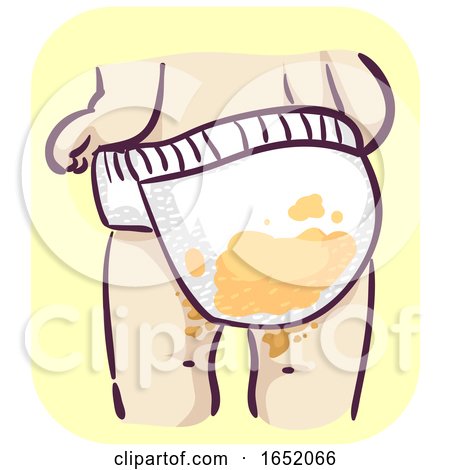 Baby Diaper Diarrhea Illustration by BNP Design Studio