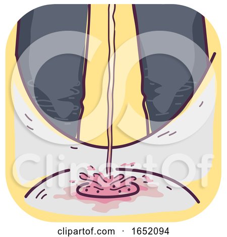 Man Urinate Pink Urine Illustration by BNP Design Studio